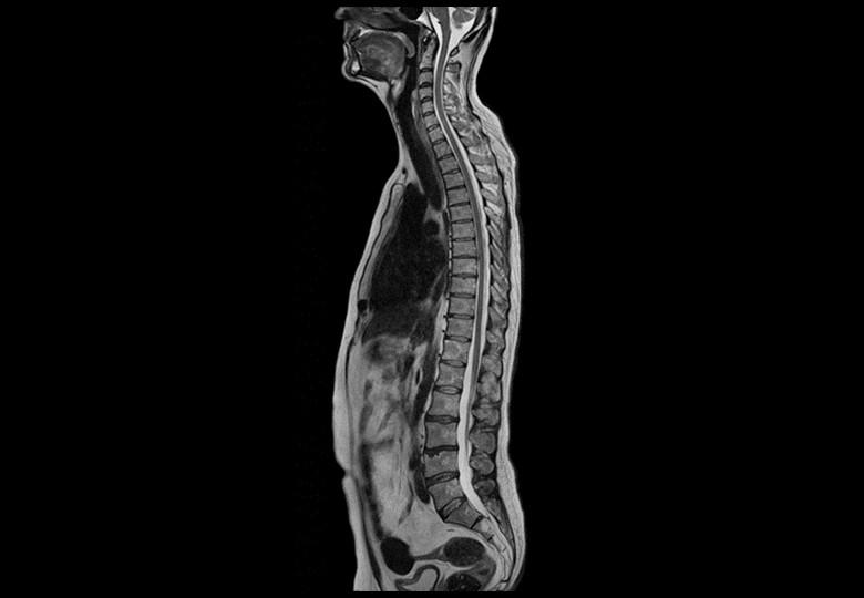 t2_fse_sag, whole spine