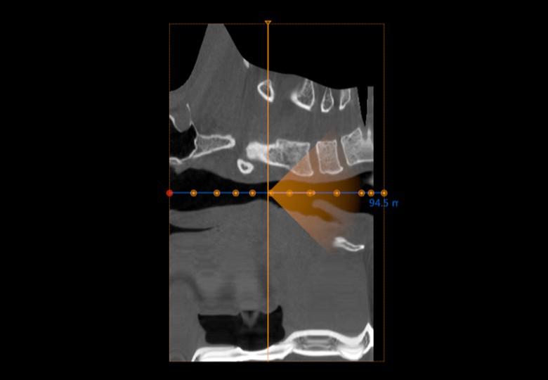 Endoscope