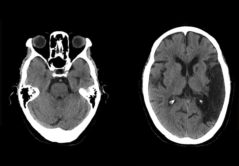 Routine scan(5mm)