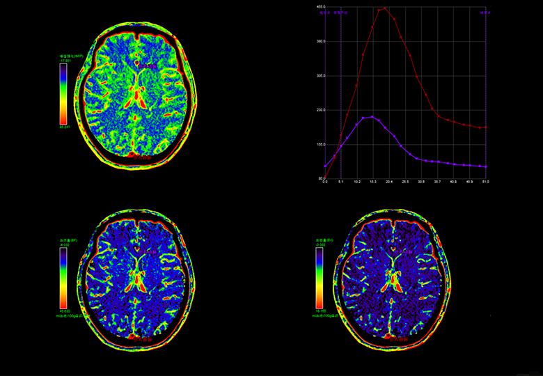 Perfusion