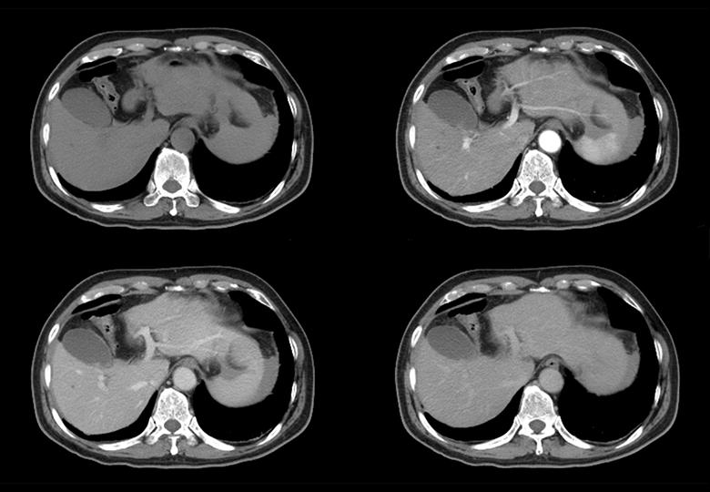 Routine scan&DCE(5mm)