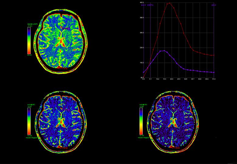 Perfusion