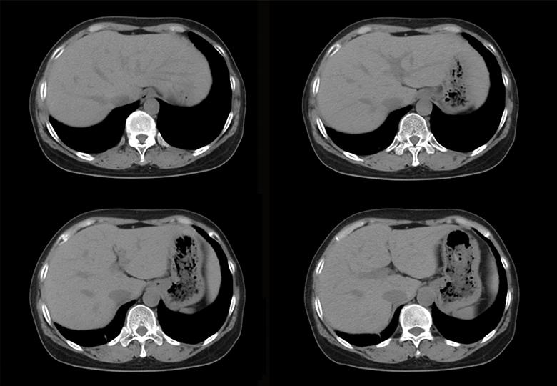 Routine scan (5.0mm)-01