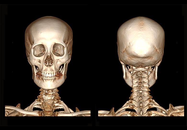  Reconstrucción VR de cabeza y cuello 