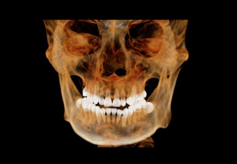  Ventana dentada 3D 