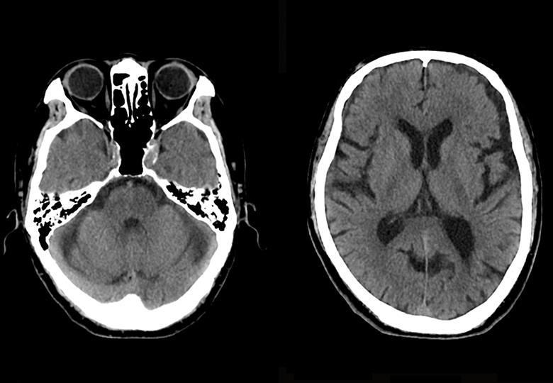 Cerebro de rutina 