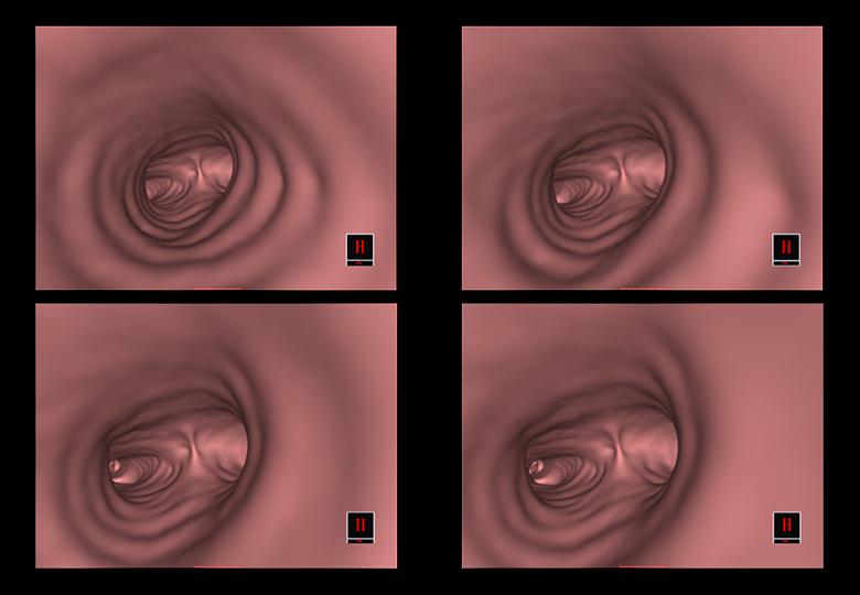 Endoscopio simulado 