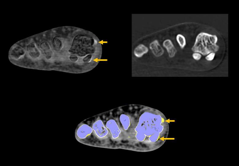 Dual energy imaging