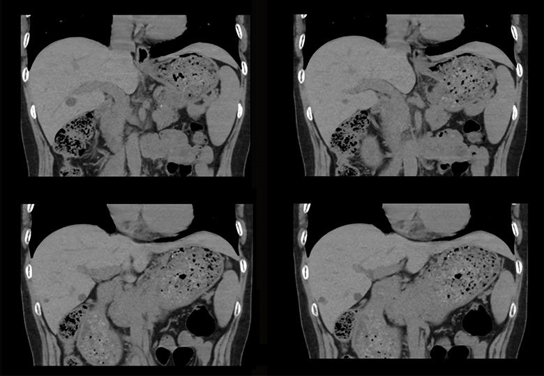 Routine scan (5.0mm)-01