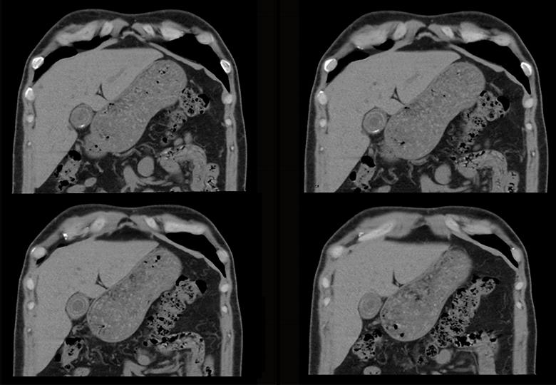 Routine scan (5.0mm)-02