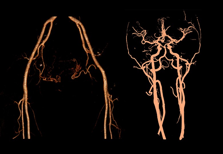 Vessel Scan