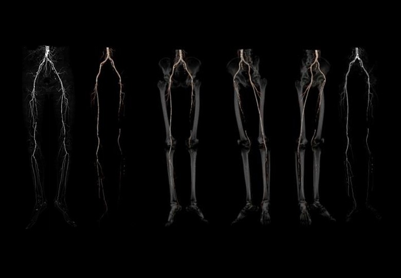 Vessel Scan