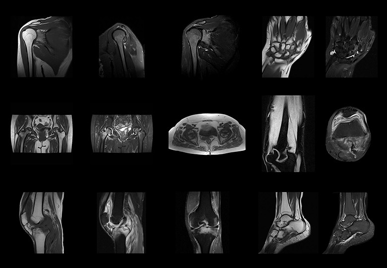 Joints Scan