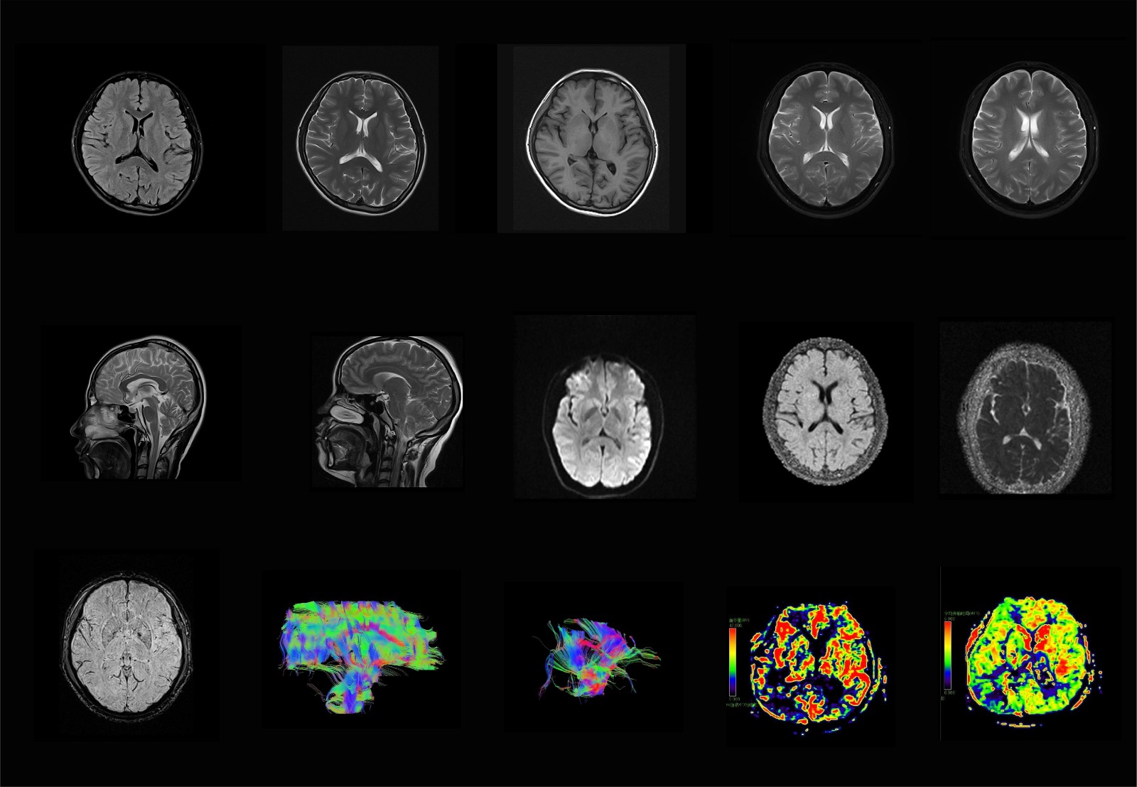 Brain Scan
